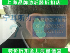 上海徐汇儿童助听器验配中心的一般价格