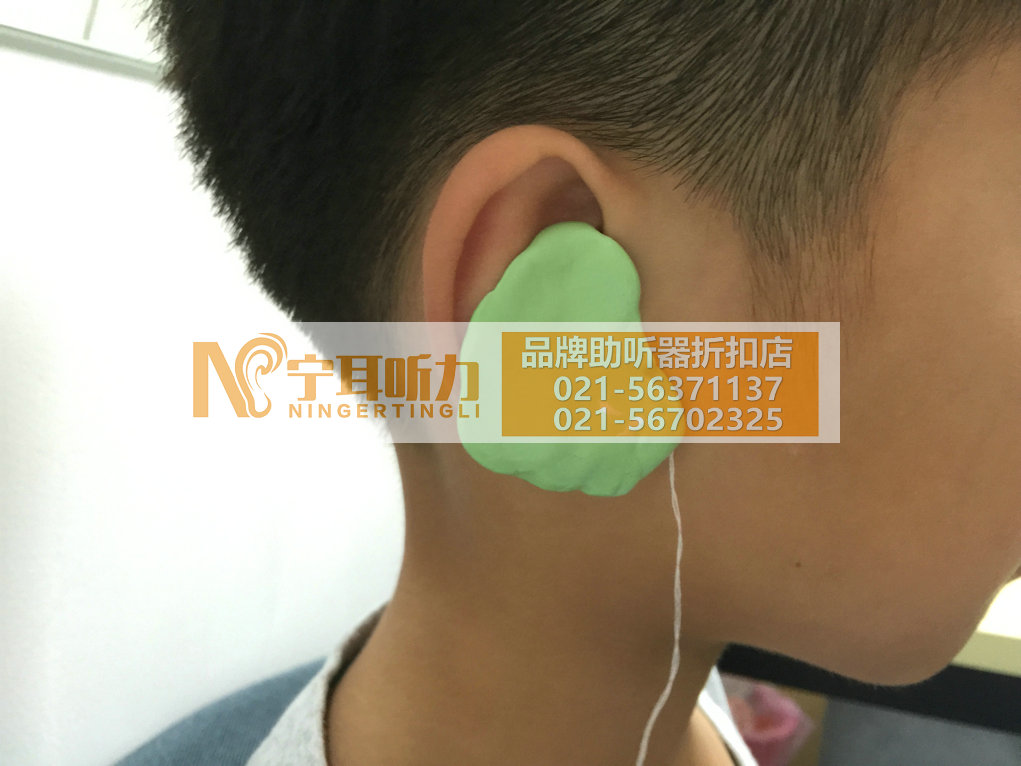 上海南汇儿童助听器折扣店