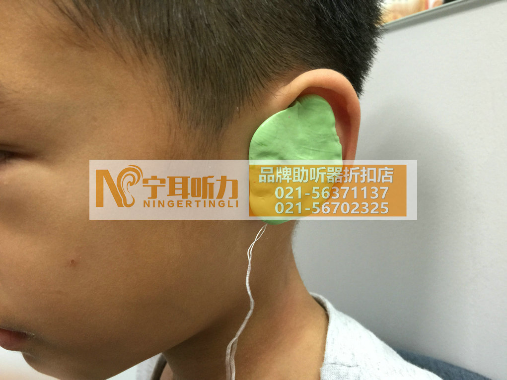 上海闵行儿童助听器折扣店
